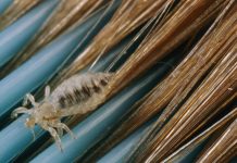 How to get rid of lice? How to get rid of lice